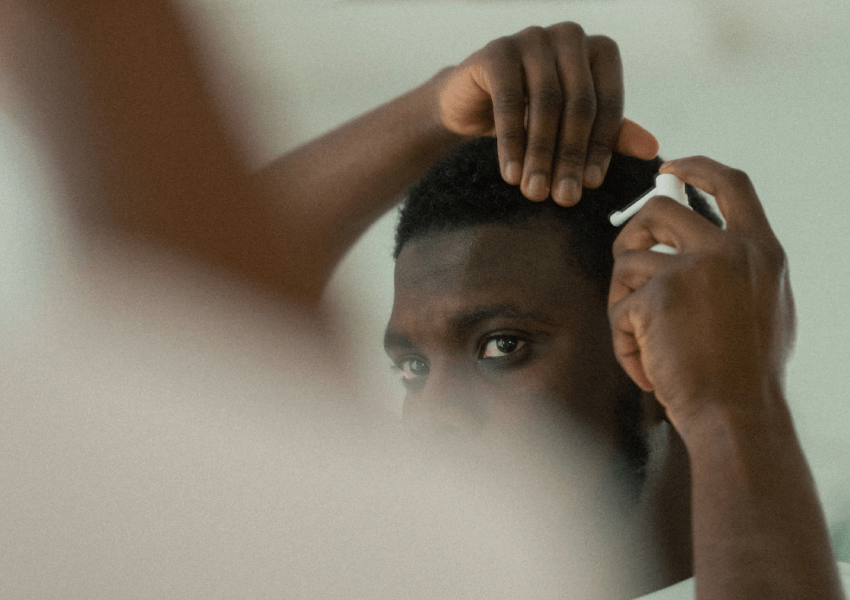 What is the Relationship Between Creatine and Hair Loss?