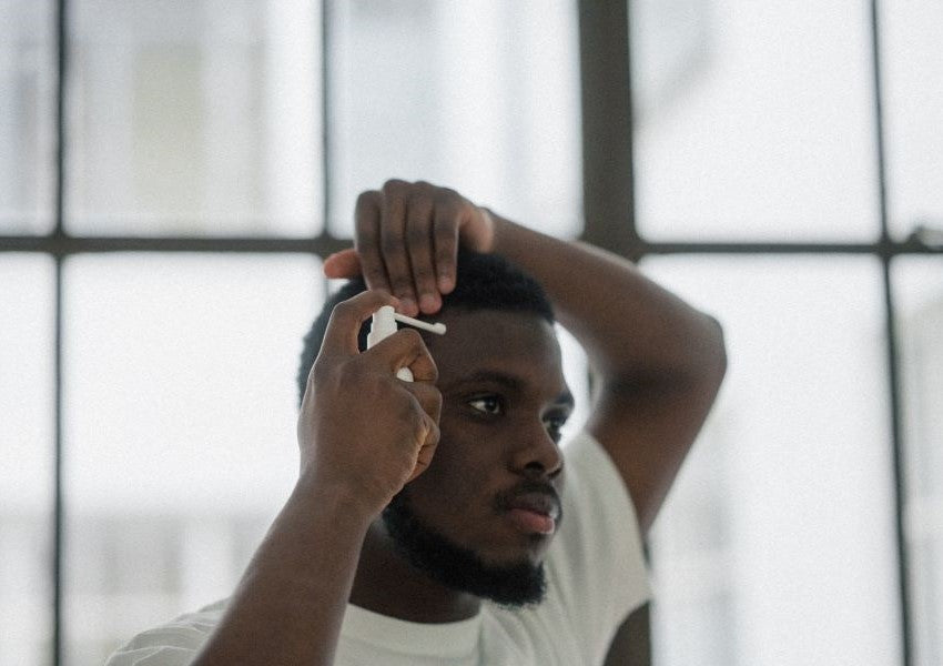 Oral Vs Topical Hair Loss Treatments: Which Is Best?